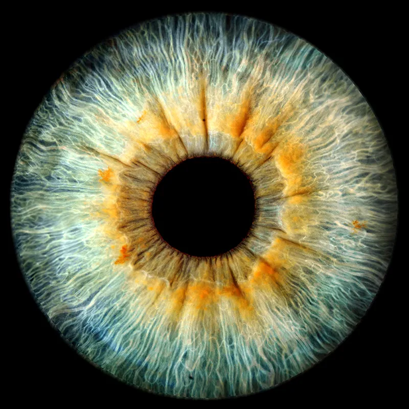 Iris 2 copiar